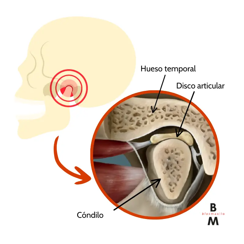 Anatomía de la articulación temporomandibular