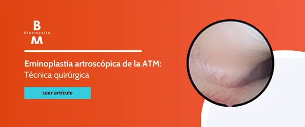 Eminoplastia artroscopica ATM