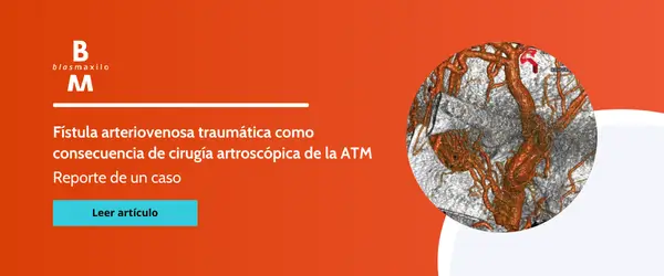 banner para ir al artículo de fístula arteriovenosa